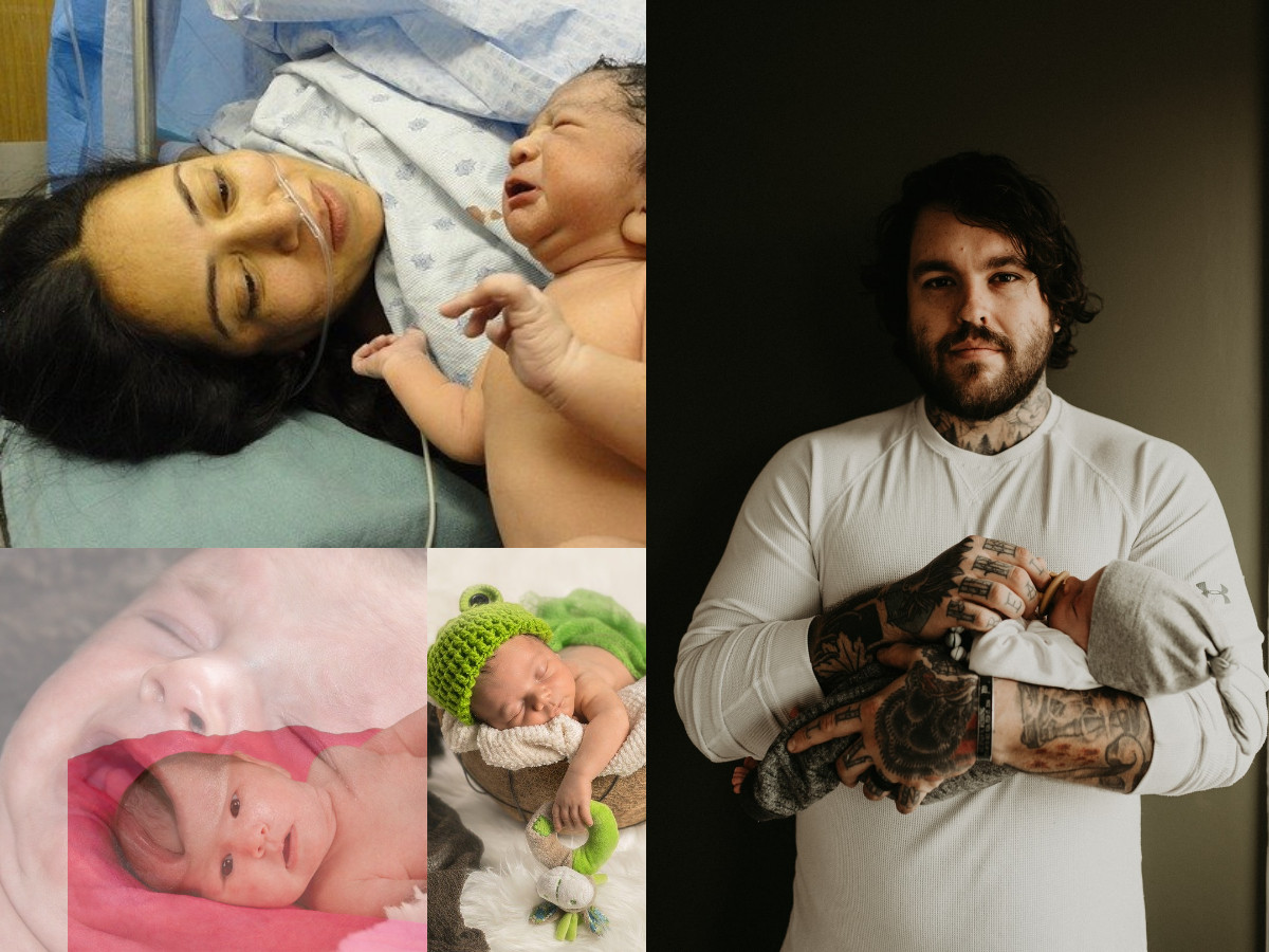 New-Born-Trauma